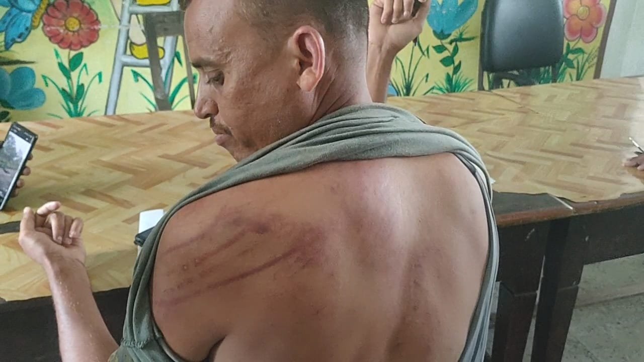 झारखण्ड जामताड़ा में कोयला चोरों का आतंक, होमगार्ड जवान को बंधक बनाकर बेरहमी से पीटा ।