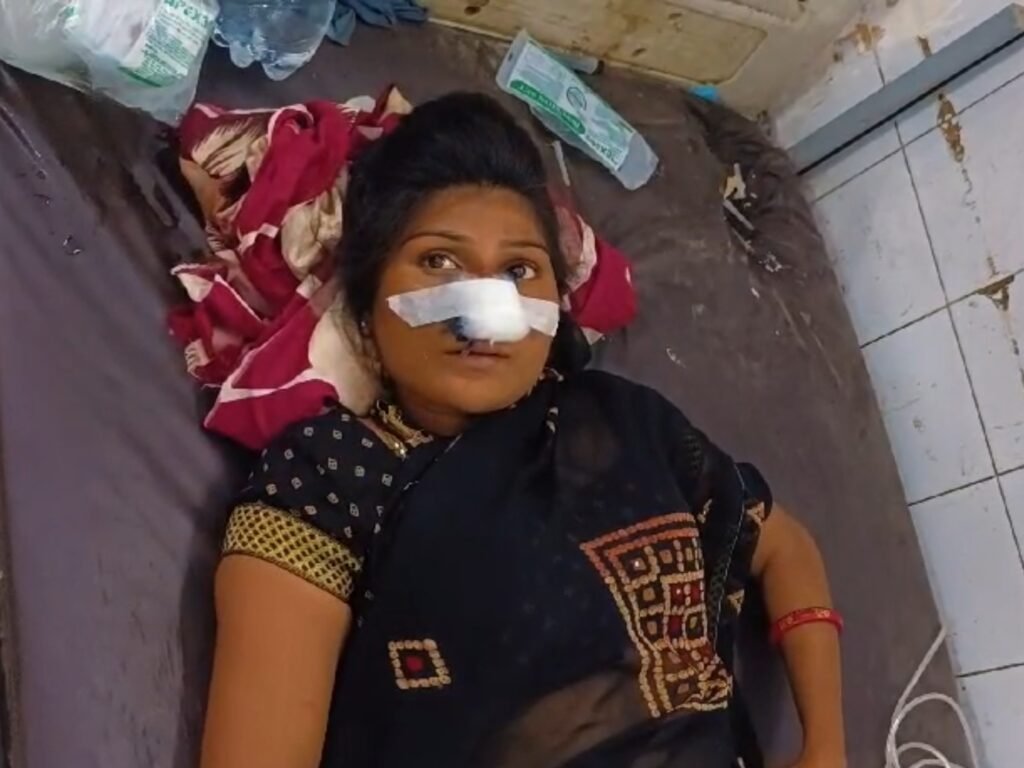 हरदोई में सांडी कस्बे के मुंशीगंज मोहल्ले में ढाई महीने पहले प्रेमी के साथ गई तीन बच्चों की मां अचानक पड़ोसी की छत से कूदकर पति के घर पहुंच गई। पति ने उसे घर में देखा तो विवाद शुरू हो गया। ओर उसकी नाक काट डाली।