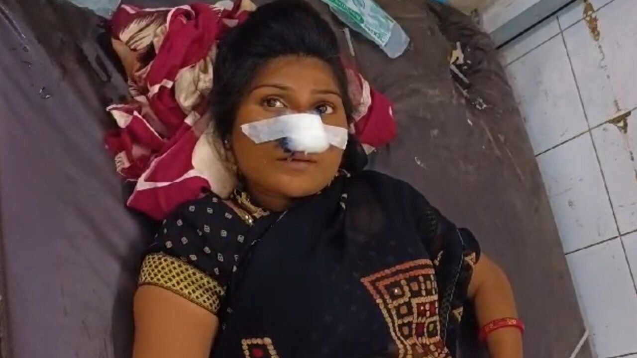 हरदोई में सांडी कस्बे के मुंशीगंज मोहल्ले में ढाई महीने पहले प्रेमी के साथ गई तीन बच्चों की मां अचानक पड़ोसी की छत से कूदकर पति के घर पहुंच गई। पति ने उसे घर में देखा तो विवाद शुरू हो गया। ओर उसकी नाक काट डाली।