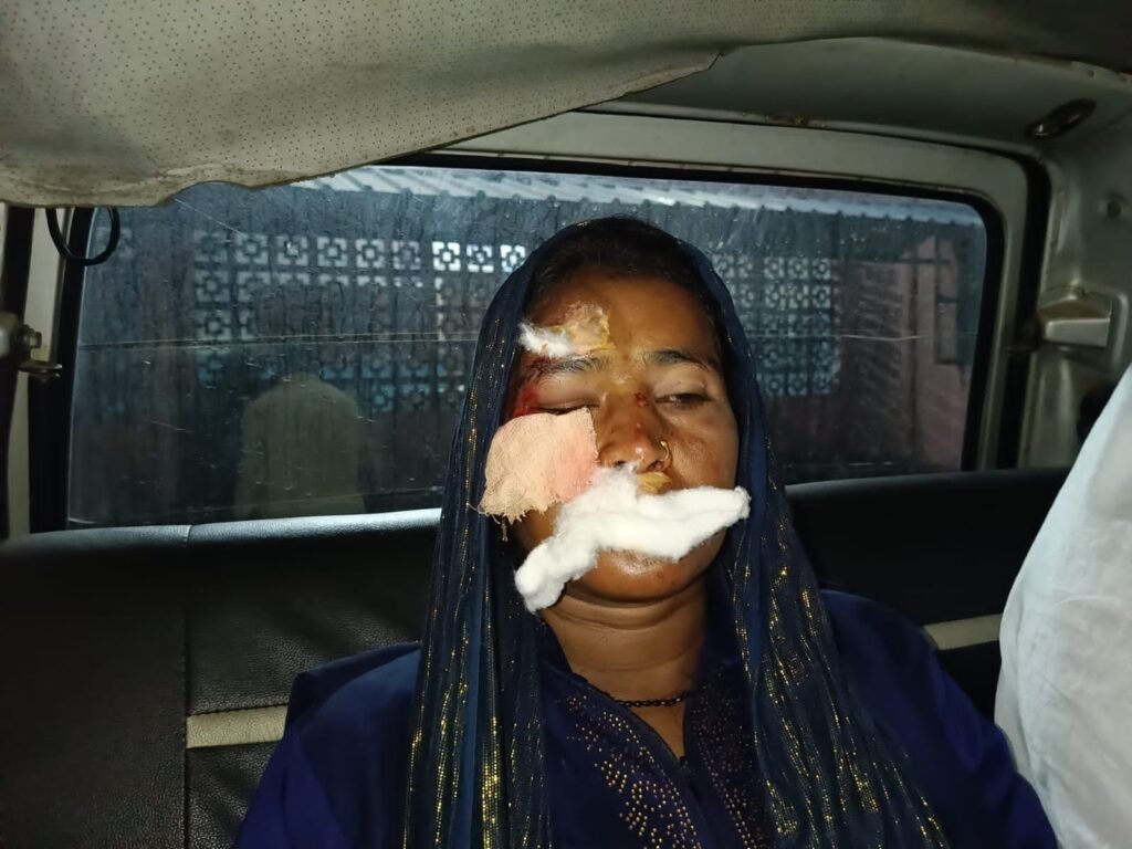 हादसे में युवती घायल, CHC में डॉक्टर नहीं मिलने पर भड़का ग्रामीणों का आक्रोश हादसे में युवती घायल, CHC में डॉक्टर नहीं मिलने पर भड़का ग्रामीणों का आक्रोश